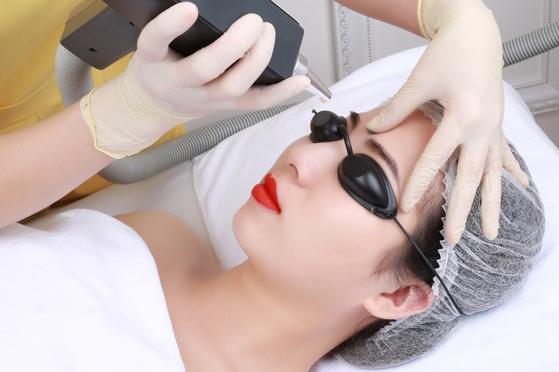 Những Điều Cần Lưu Ý Sau Khi Xóa Xăm Bằng Laser