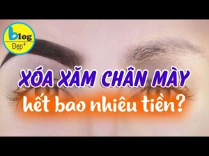 xoa xam chan may bang laser cong nghe hien dai 66de87279085e