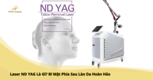 laser nd yag là gì