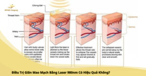 May triet long tai nha 3 11