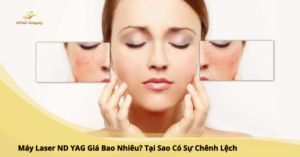 máy laser nd yag giá bảo nhiều