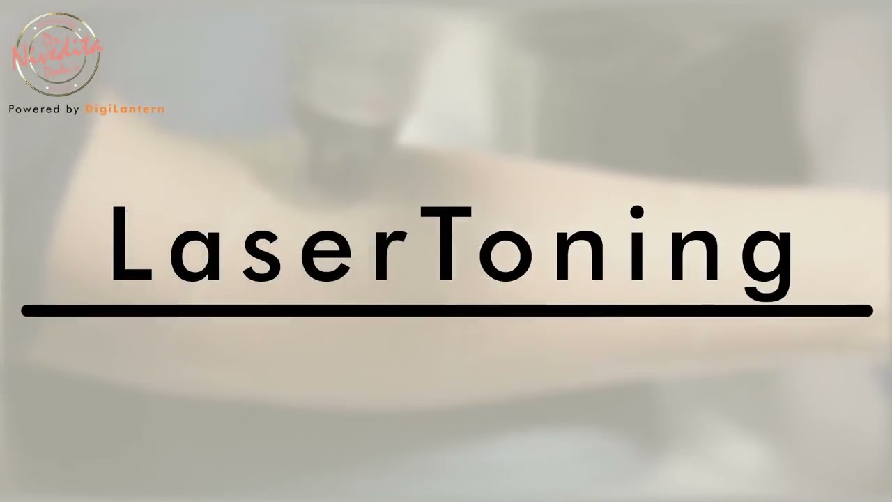 Giới thiệu về Laser Toning