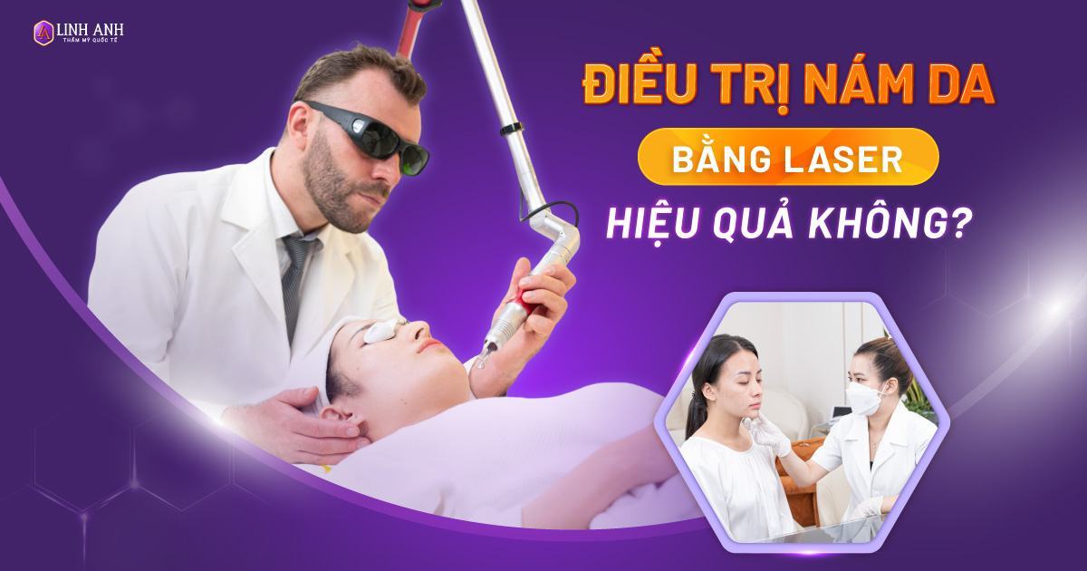 Laser trị nám là gì?