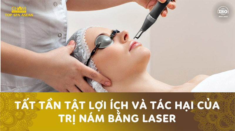 Laser trị nám là gì?