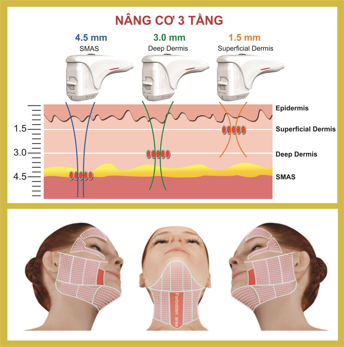 Máy Nâng Cơ HIFU Có Thật Sự Thay Đổi Khuôn Mặt Sau Một Lần Sử Dụng?