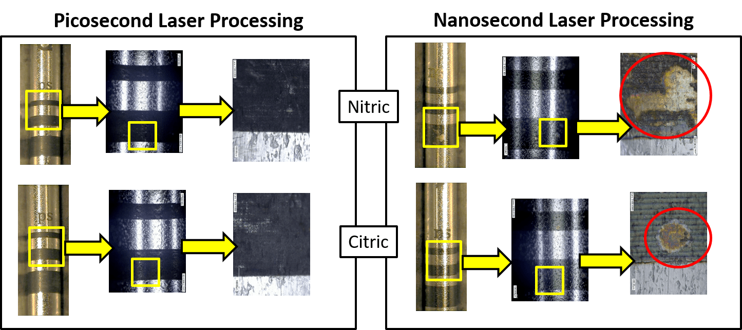 Nanosecond và Picosecond – Sự Khác Biệt và Ứng Dụng Trong Thẩm Mỹ