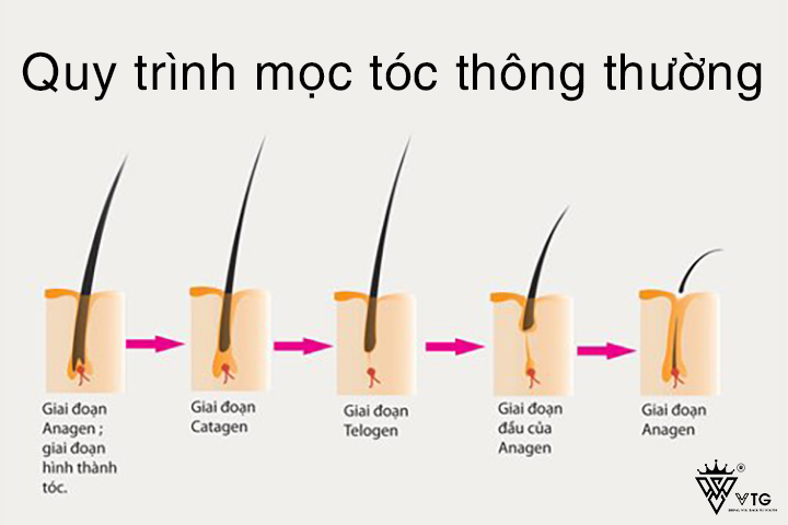 6 cách kích thích mọc tóc