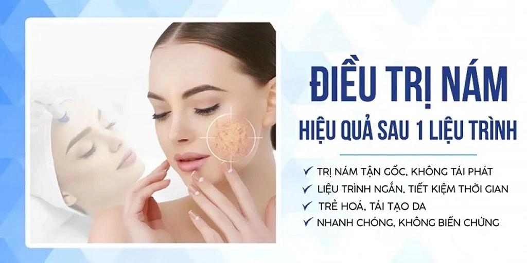 Các phương pháp điều trị nám tốt nhất