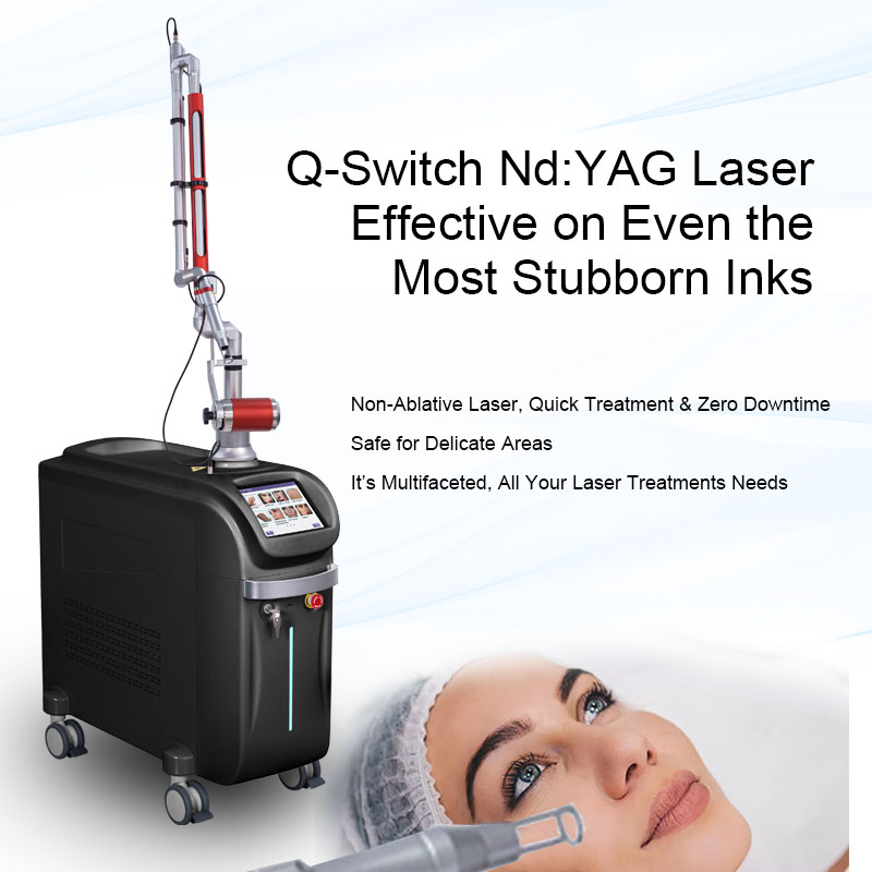 Điều trị nám bằng laser qswitch