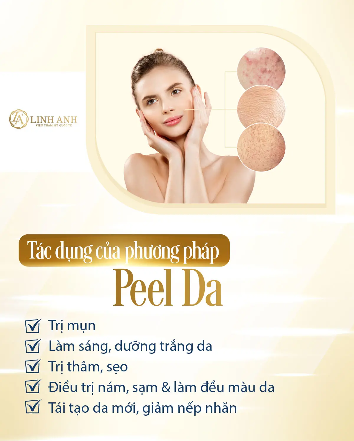 Điều trị nám bằng phương pháp peel