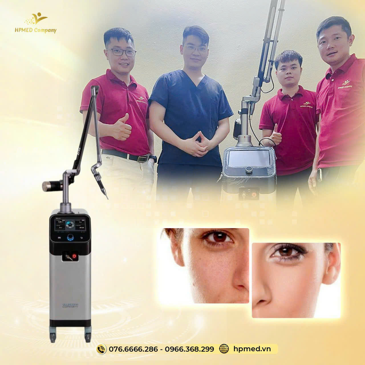 hpmed chuyen giao may laser iris cho bac sy viet 2