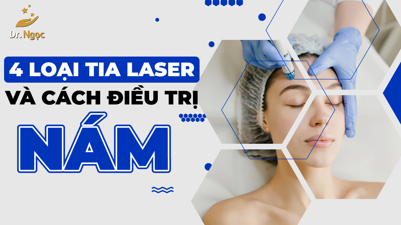 Những tai biến khi điều trị nám bằng laser