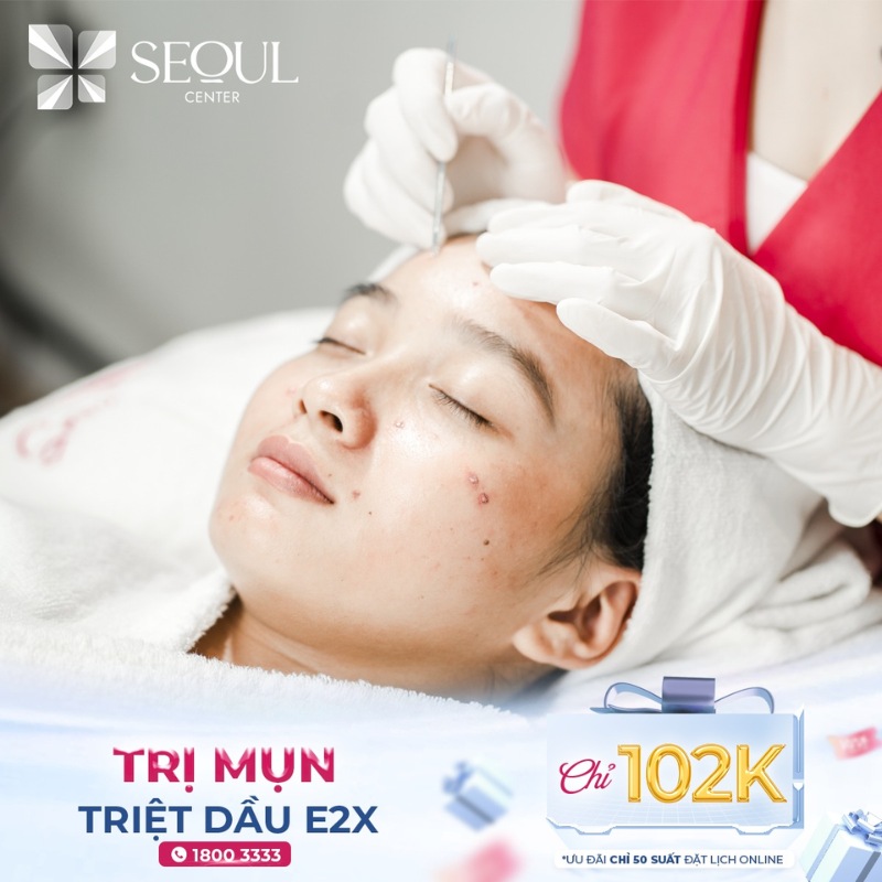 Spa Trị Mụn Là Gì? các phương pháp trị mụn tại spa !