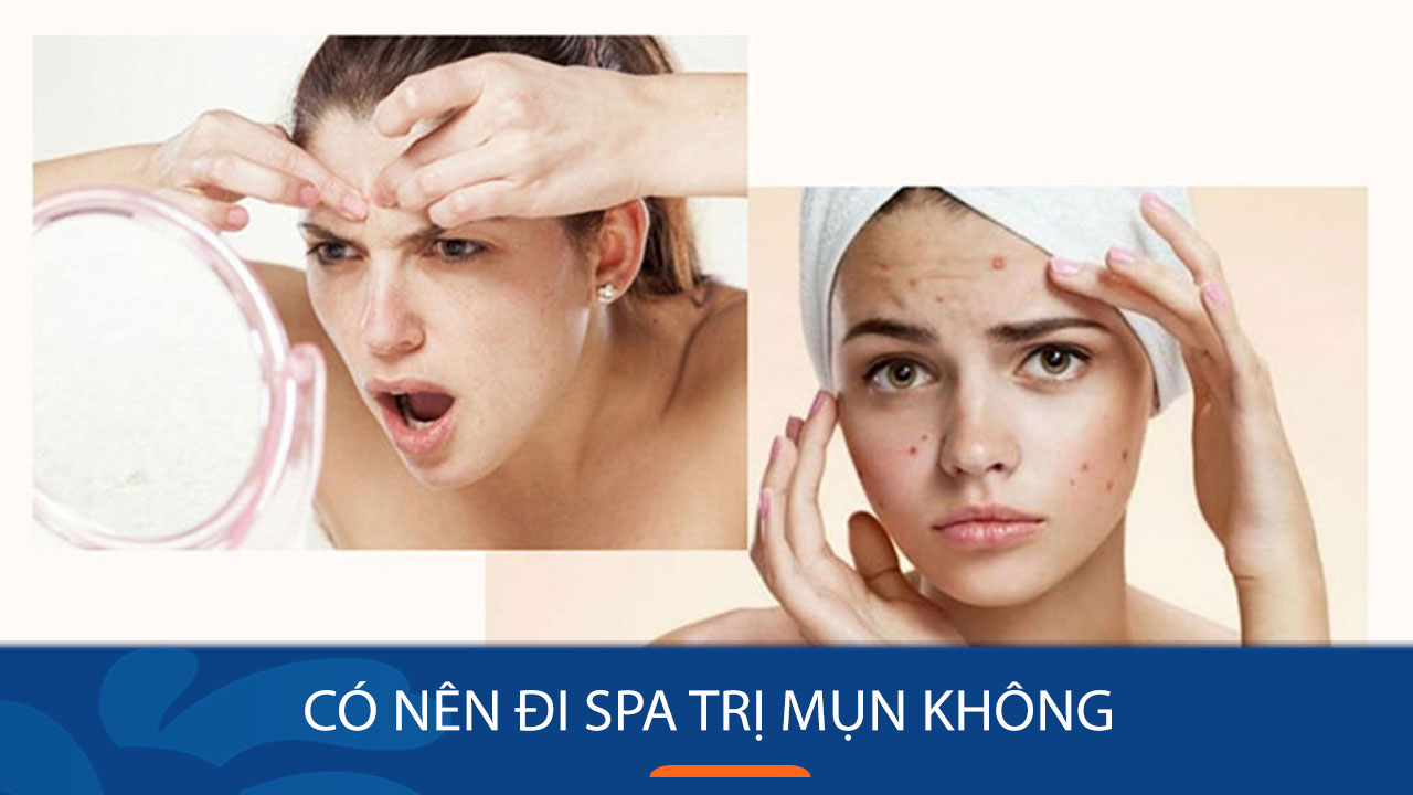 Spa Trị Mụn Là Gì? các phương pháp trị mụn tại spa !