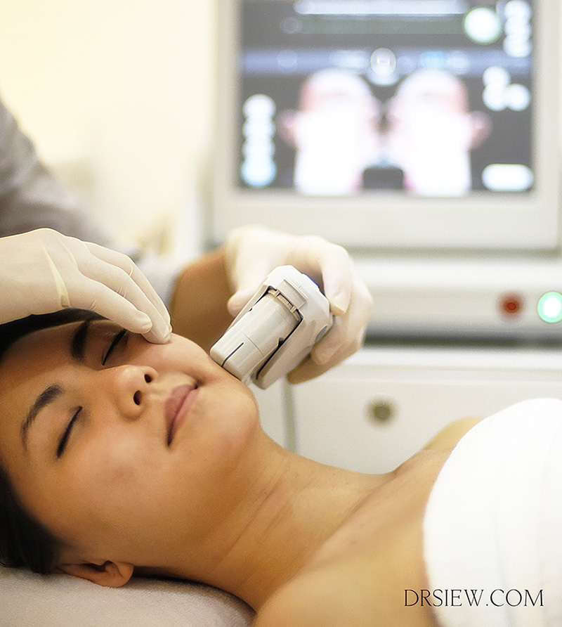 Discover the Top 10 Cosmetic Machines - Transform Your Beauty Routine