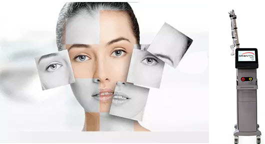 Unlocking the Power of Fractional CO2 Laser Machines - A Transformative Approach to Skin Rejuvenation