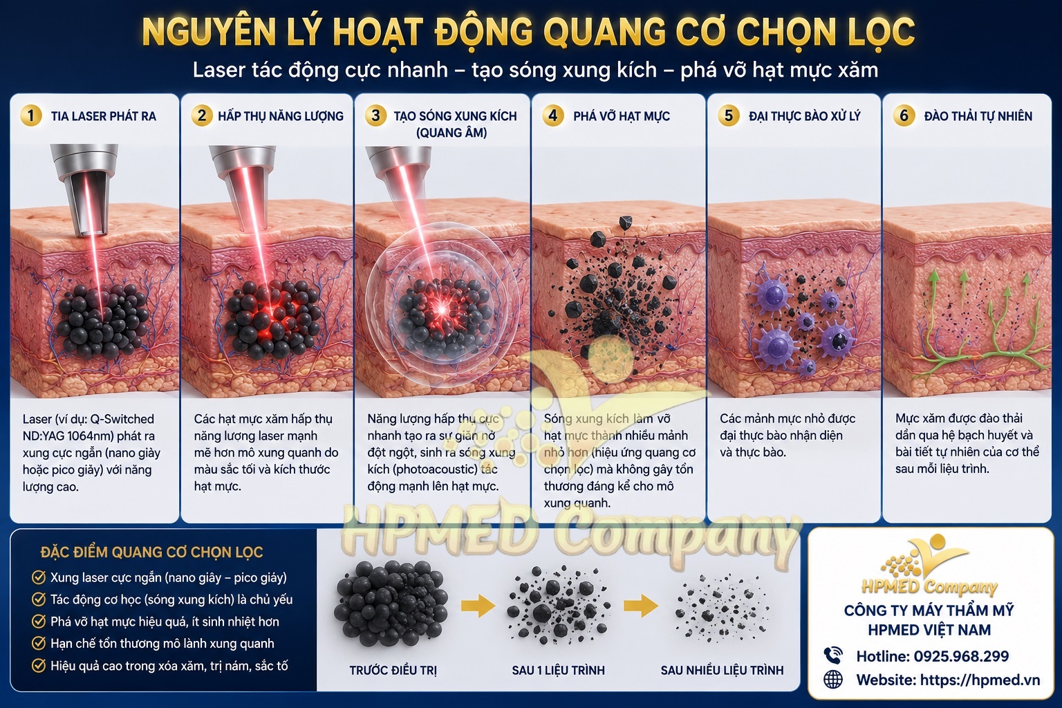 So sánh hiệu ứng Quang nhiệt và Quang cơ của Laser Nanosecond và Picosecond 3 Sơ đồ nguyên lý quang cơ chọn lọc của laser xung siêu ngắn picosecond tại HPMED