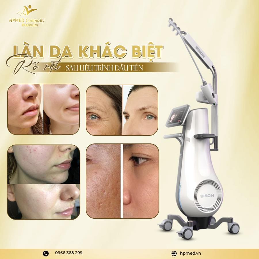 Máy Rf Vi Kim Eladerm Hàn Quốc