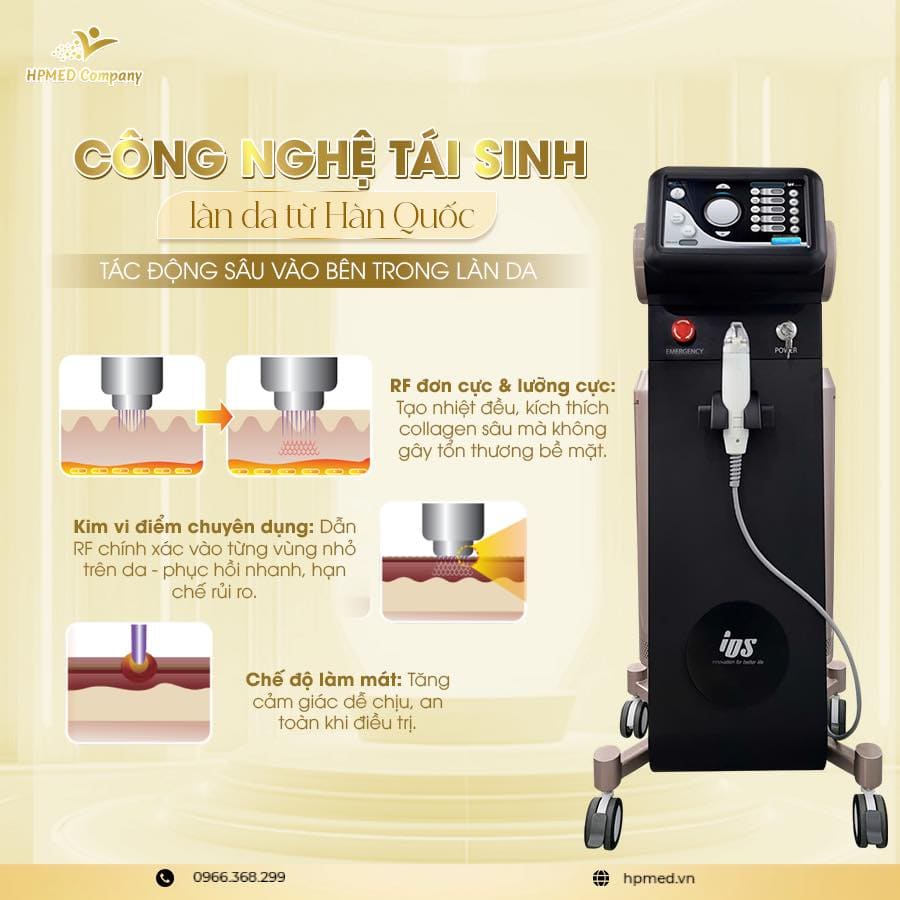 Máy Rf Vi Kim Pinacle Hàn Quốc