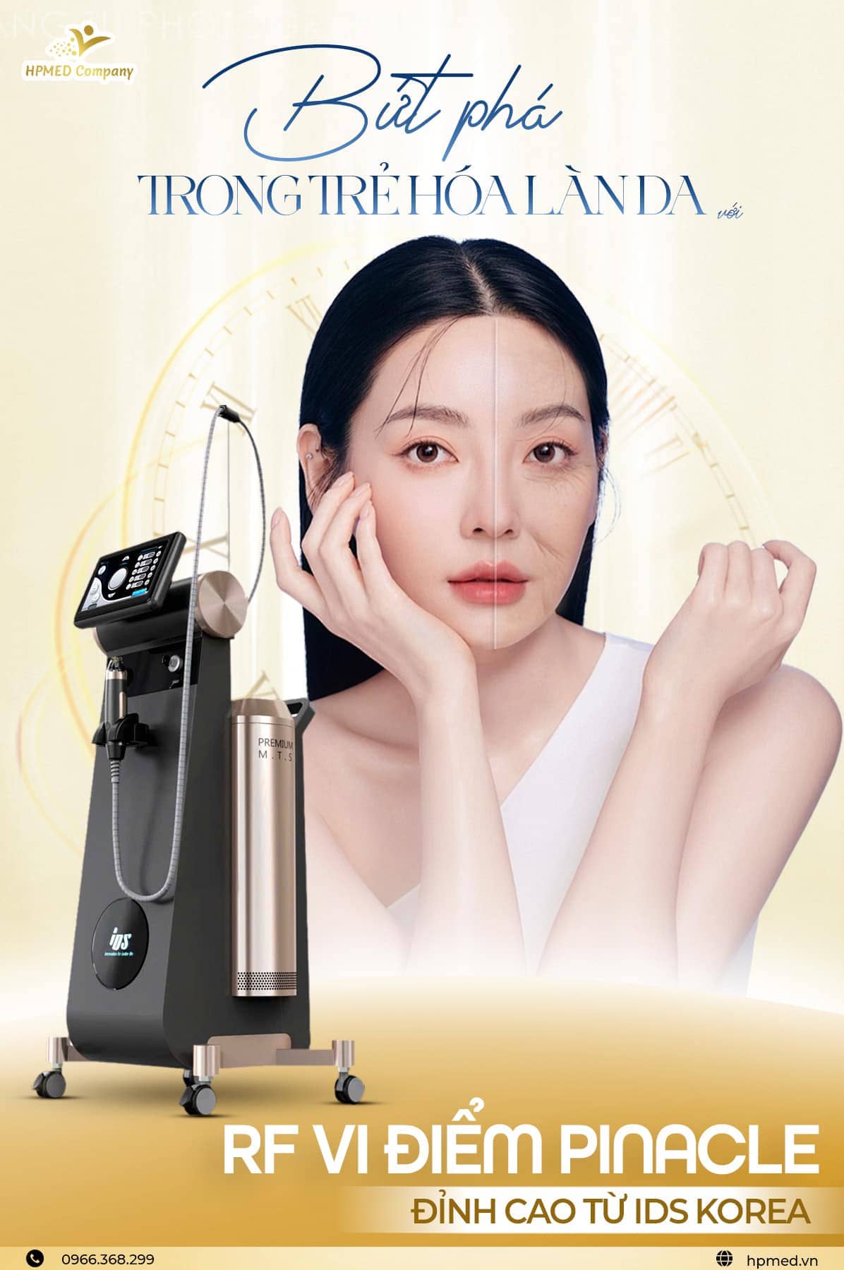 Máy Rf Vi Kim Pinacle Hàn Quốc
