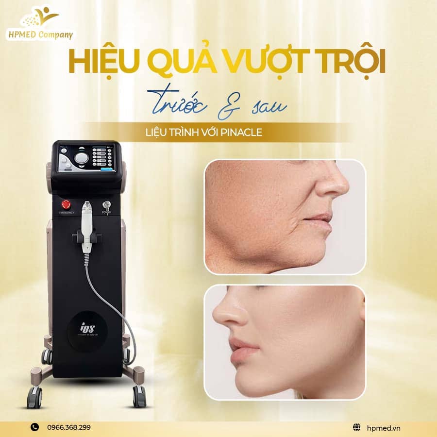 Máy Rf Vi Kim Pinacle Hàn Quốc