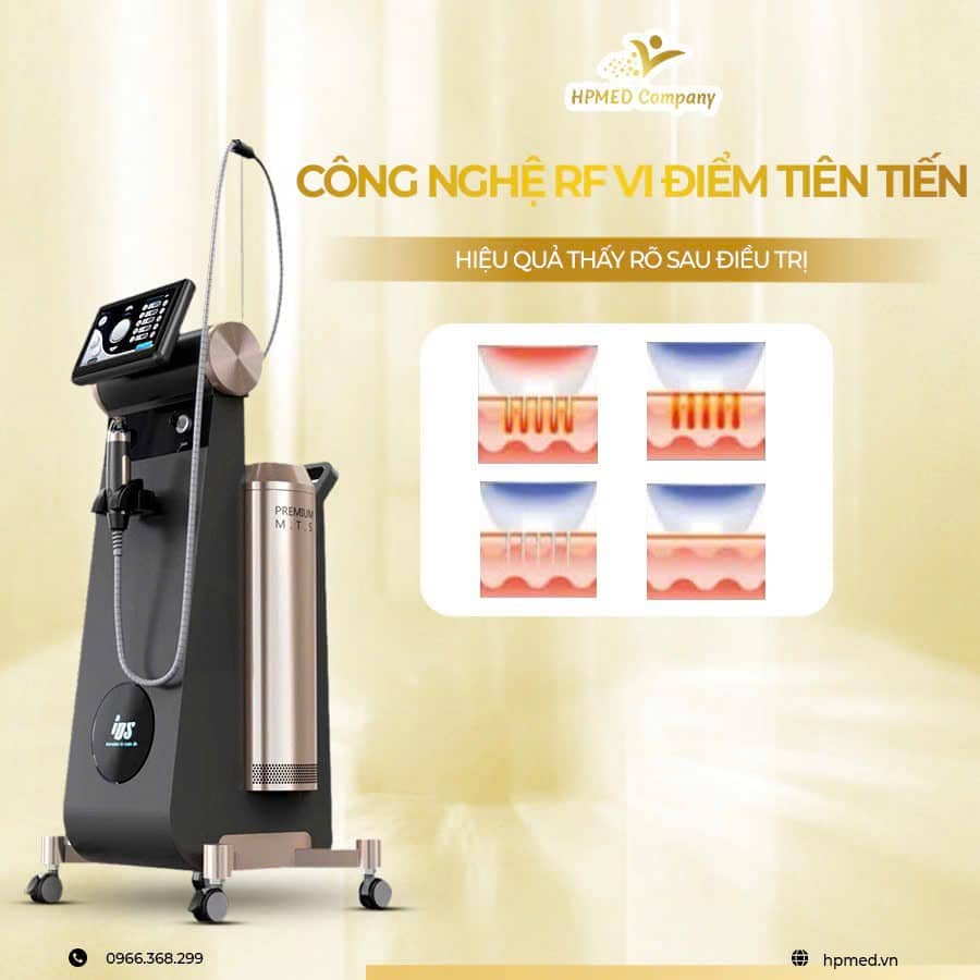 Máy Rf Vi Kim Pinacle Hàn Quốc
