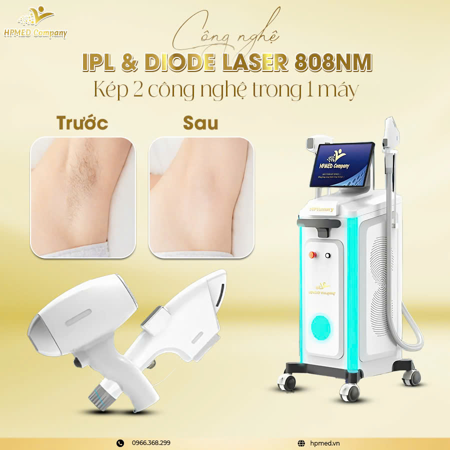 Máy Triệt Lông HPLUXURY DIODE LASER - DPL Máy Triệt Lông HPLUXURY DIODE LASER - DPL