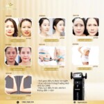 Máy HIFU Nâng Cơ Inofus Cao Cấp Hàn Quốc