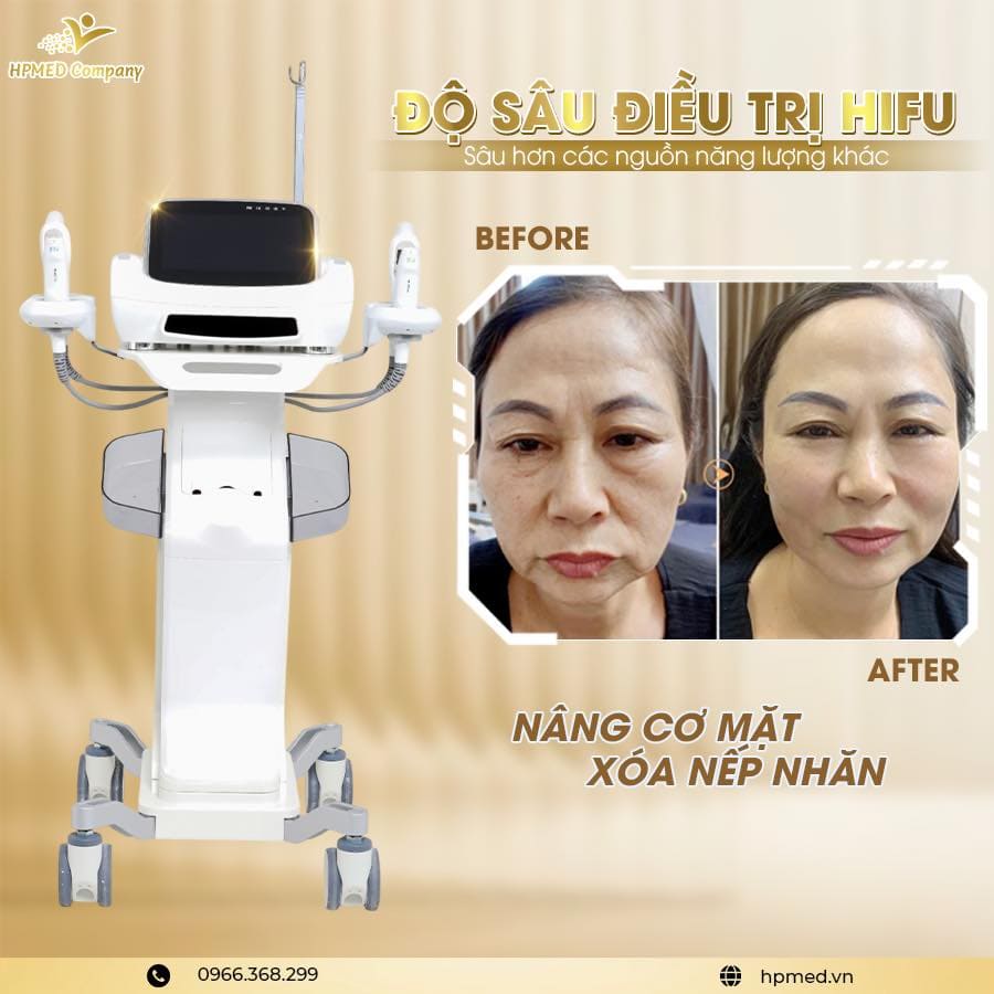 Máy HIFU Nâng Cơ Medilux