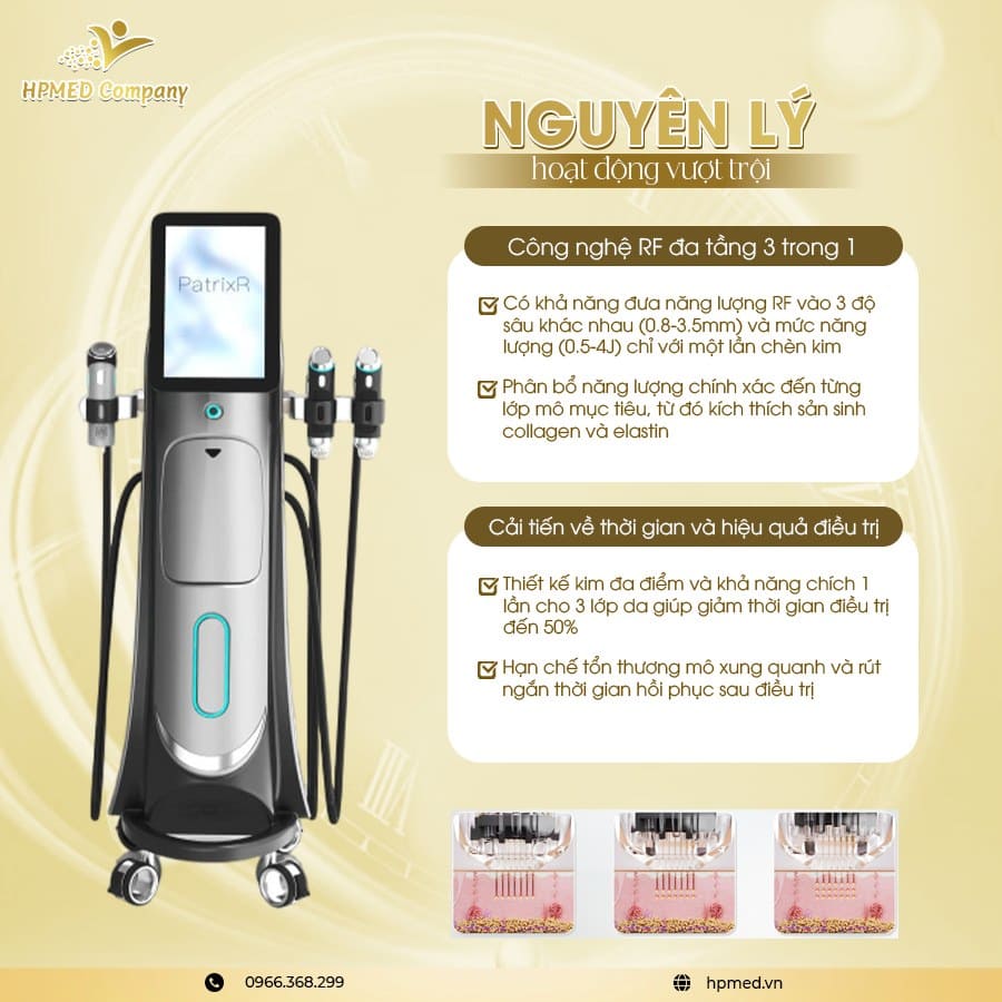 Máy RF Vi Điểm PatrixR Bắc Kinh