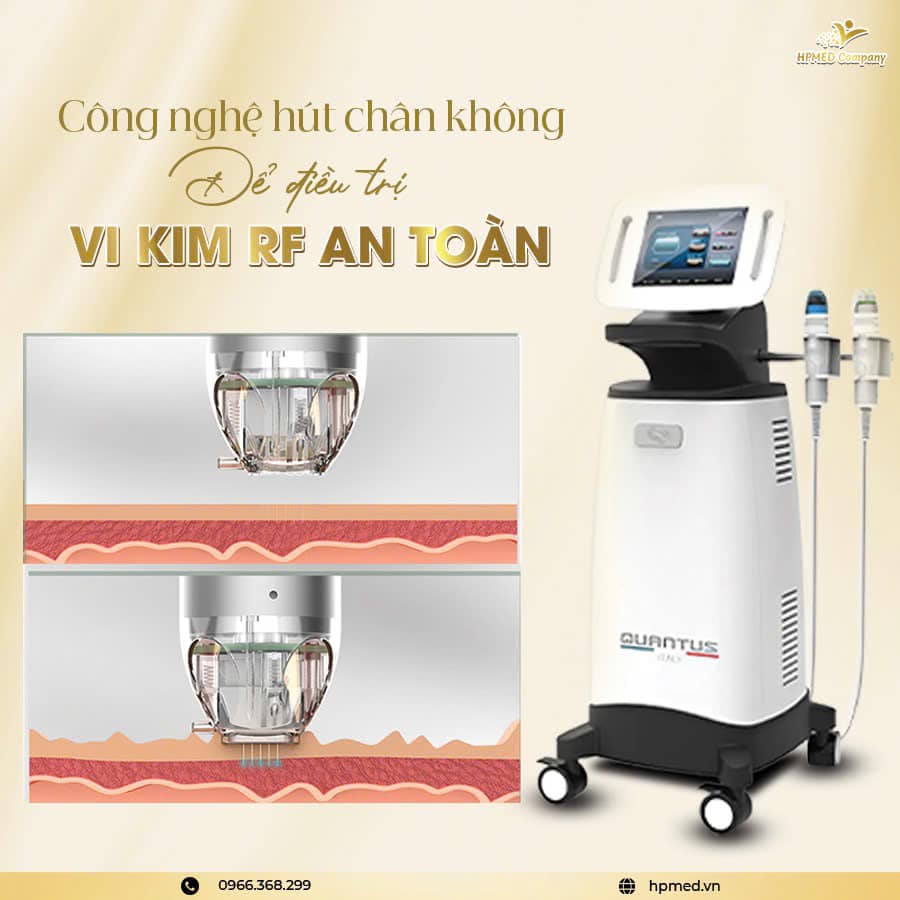Máy Rf Vi Điểm Quantus Bắc Kinh