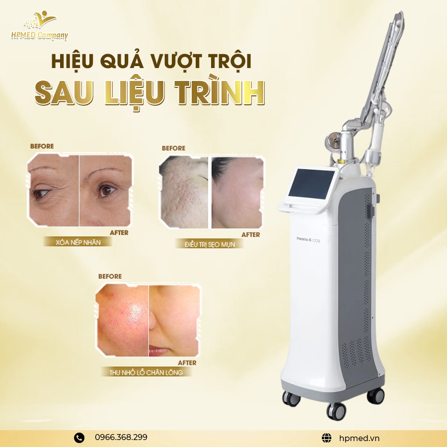 Máy laser co2 fractional s co2 công nghệ máy laser co2 và máy fractional co2 chuyên trị sẹo rỗ trẻ hóa da chính hãng tại HPMED
