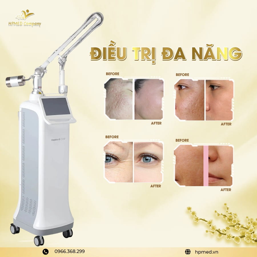 Máy laser co2 fractional s co2 công nghệ máy laser co2 và máy fractional co2 chuyên trị sẹo rỗ trẻ hóa da chính hãng tại HPMED