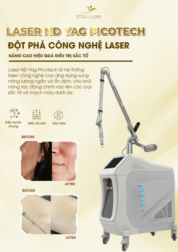 Máy Laser Picotech Premium – Hệ Laser 3 Trong 1 Cho Xóa Xăm, Sắc Tố, Mạch Máu Và Trẻ Hóa Da