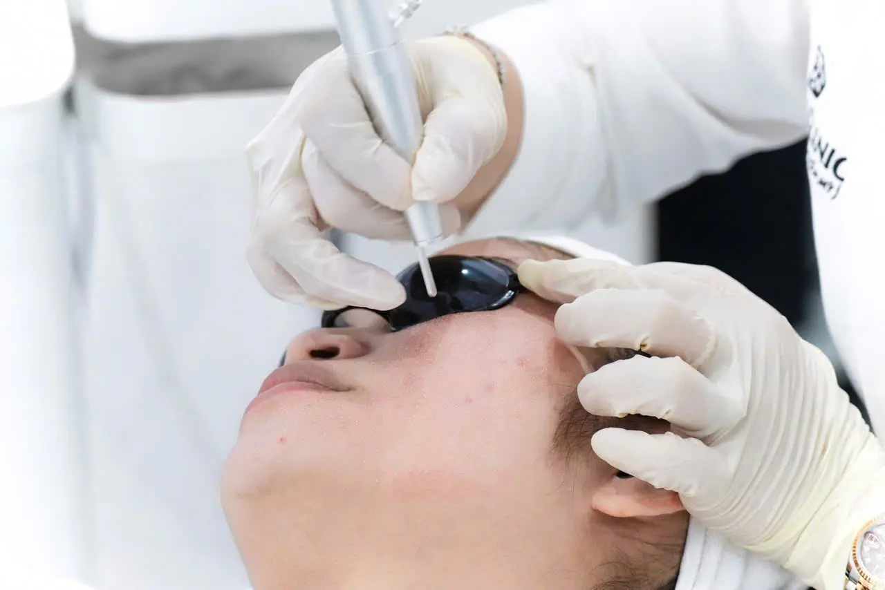 Thao tác tay cầm Laser CO2 Fractional tại AKINA