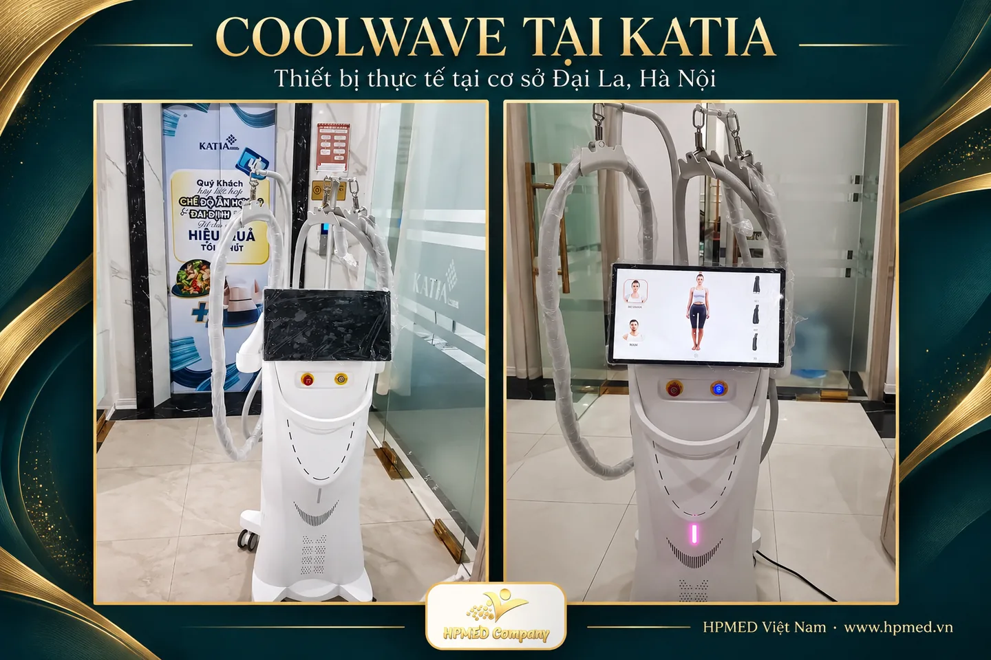 Thiết bị Coolwave thực tế tại Thẩm mỹ viện KATIA, Đại La, Hà Nội